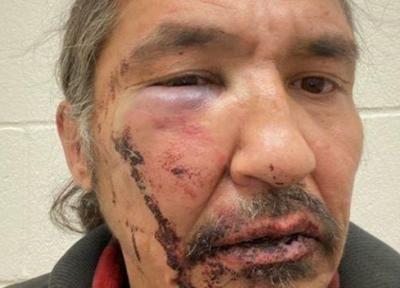 جنجال کتک زدن شهروند بومی توسط پلیس کانادا، نخست وزیر کانادا: شوک آور و بی رحمانه